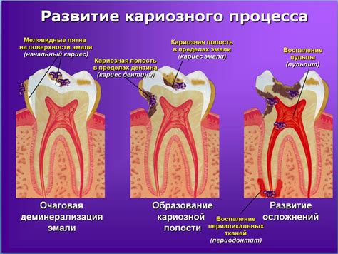 Больно ли удалять нерв из зуба