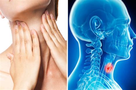 Первые симптомы рака горла
