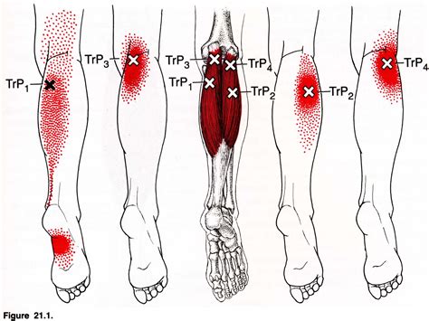 Почему болят мышцы ног