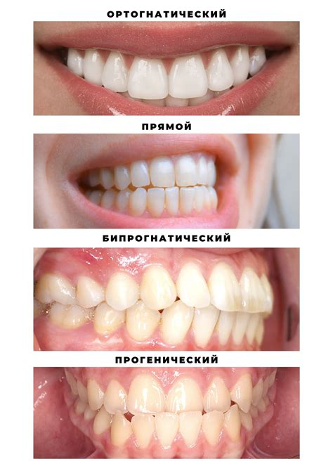 Правильный прикус зубов у человека фото