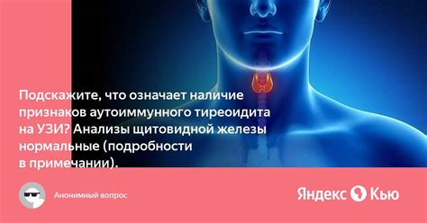 Признаки аутоиммунного тиреоидита щитовидной железы у женщины