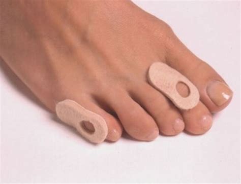 Сухой мозоль на пальце ноги лечение