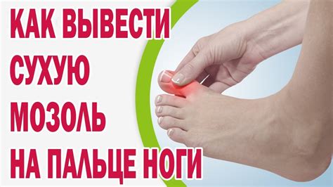 Сухой мозоль на пальце ноги лечение
